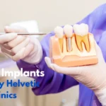Dental Implants Hungary Helvetic Clinics