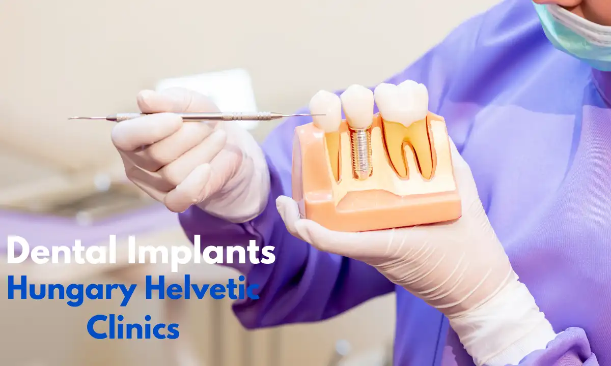 Dental Implants Hungary Helvetic Clinics:  A Leading Choice for International Patients